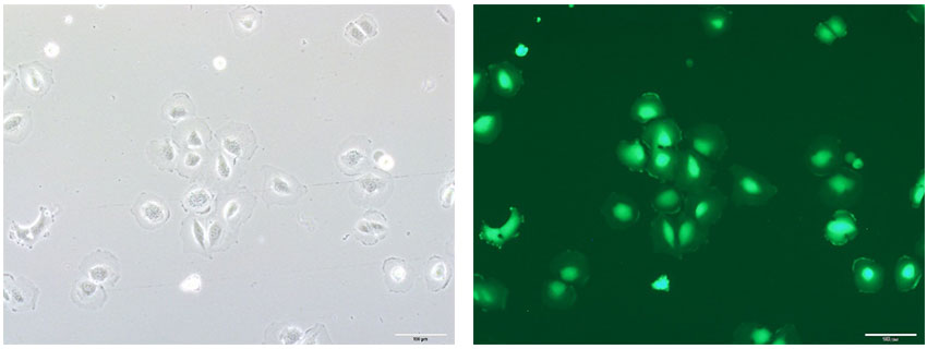 Bright-field image (left) and fluorescence image (right) of cells transfected with fluorescent protein